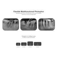 Dimage  Fosfor Plak Tarama Cihazı  D100 