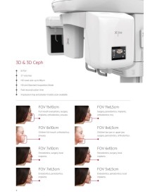 X LINE TOMOGRAFİ CİHAZI   FOV   11X 10