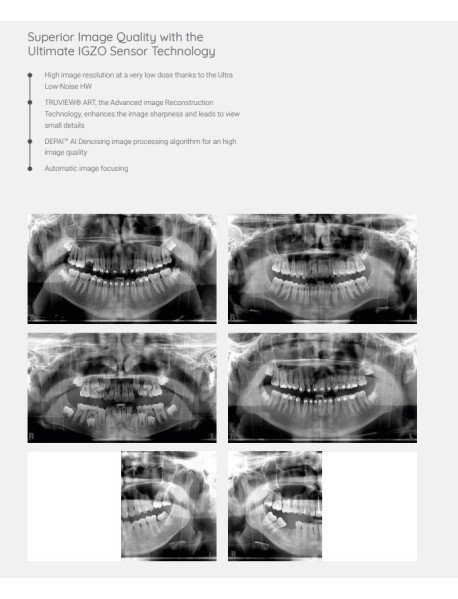 X LİNE İtaly Panoramik Röntgen Cihazı X LİNE İtaly Panoramik Röntgen Cihazı
